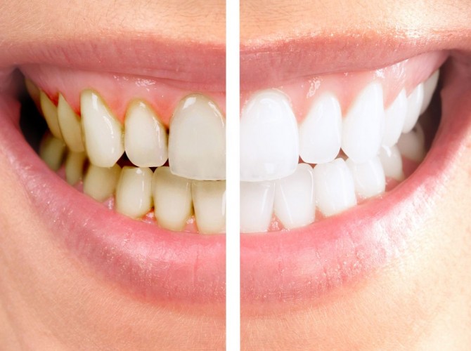 Estetica dentara